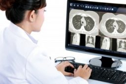 Tecnologia para reconhecimento de voz para laudos em radiologia