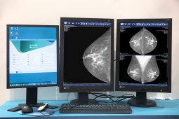 Hanging Protocols e a otimização do tempo do radiologista