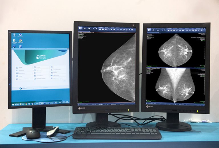 Hanging Protocols e a otimização do tempo do radiologista