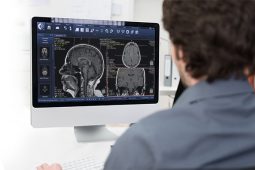 Pixeon leva para a JPR software de gestão de imagem para centros de radiologia