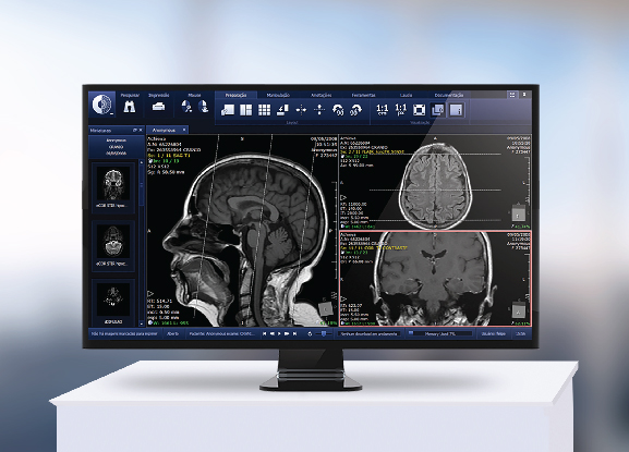 Pixeon é a única avaliada pela KLAS no Global PACS 2016 com notas acima da média do mercado Latino Americano