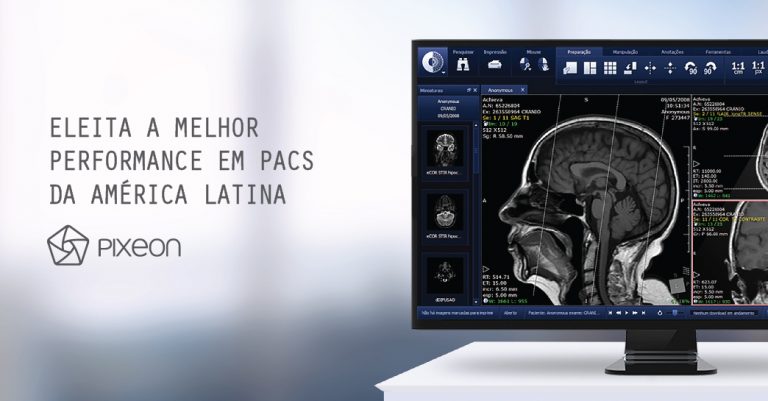 PACS Aurora tem a melhor performance de PACS da América Latina