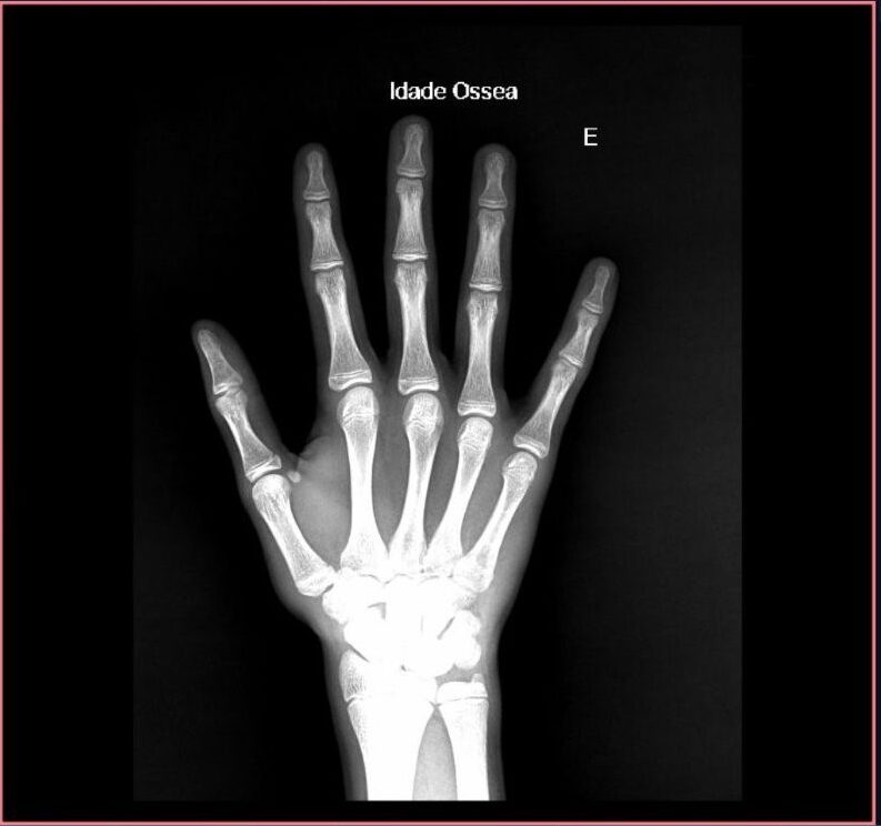 intelig&ecirc;ncia artificial na radiologia, Intelig&ecirc;ncia Artificial na Sa&uacute;de: exemplos de IA para radiologia
