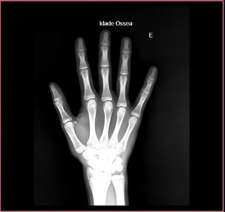 IA para radiología, Inteligencia Artificial en la Salud: Ejemplos de IA para radiología