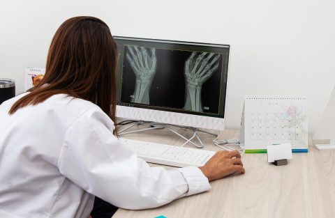 clínica digital, Como calcular a idade óssea com Inteligência Artificial?