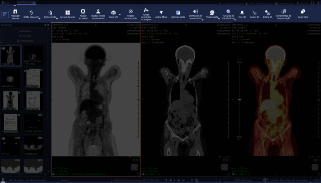 New Predefined Toolbars Improve PACS Usability for Radiologists