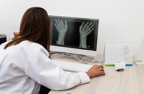 Medicina preventiva, ¿Cómo calcular la edad ósea con Inteligencia Artificial?