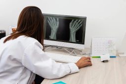 How to Calculate Bone Age with Artificial Intelligence?