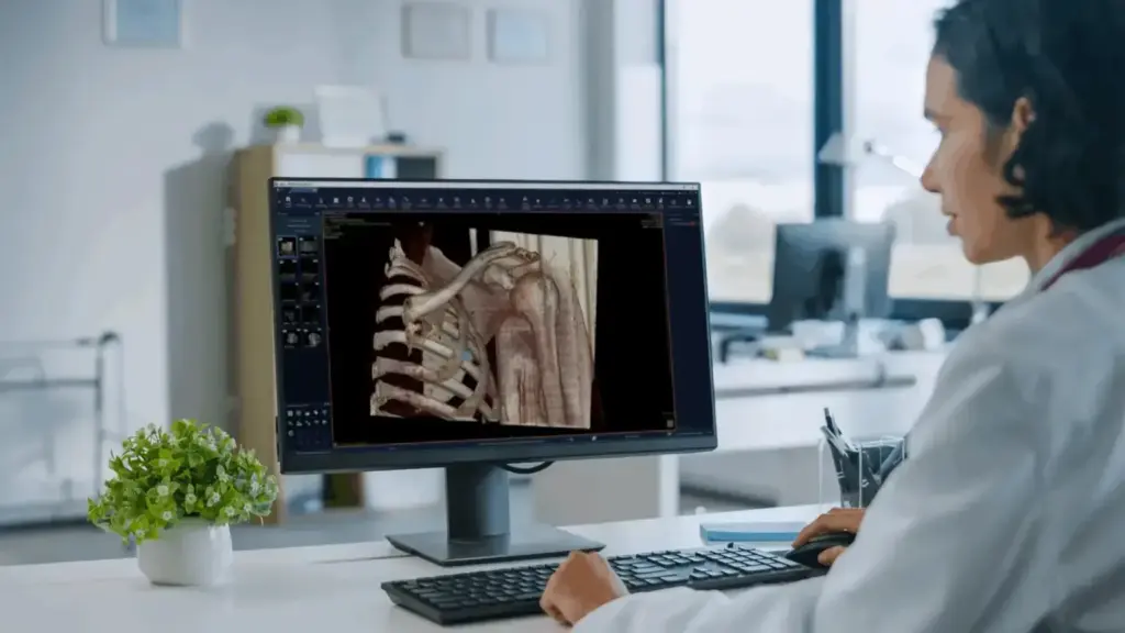 Nuevo recurso de medición de ángulos para ortopedia disponible en el PACS Pixeon Aurora